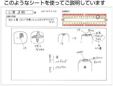 説明シート