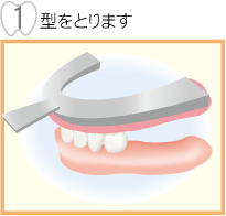 型をとります